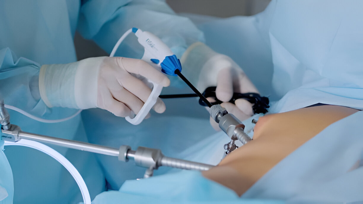 Best Laparoscopic Surgeon In Andheri